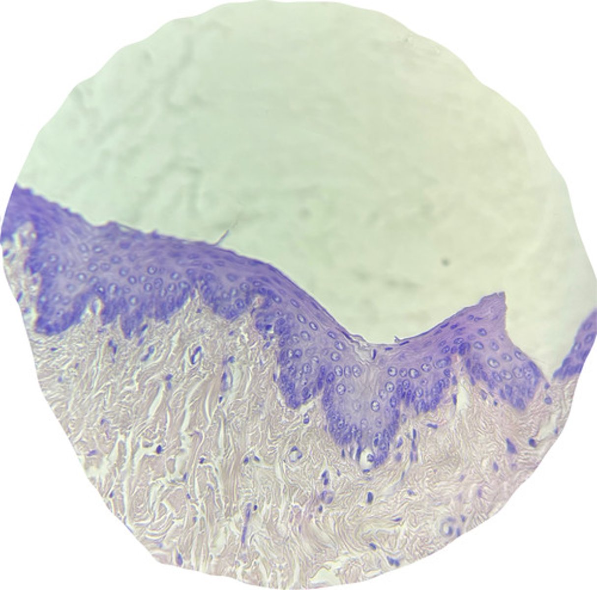 <p>since this sample has ________ epithelium, what part of the body did it come from?</p>