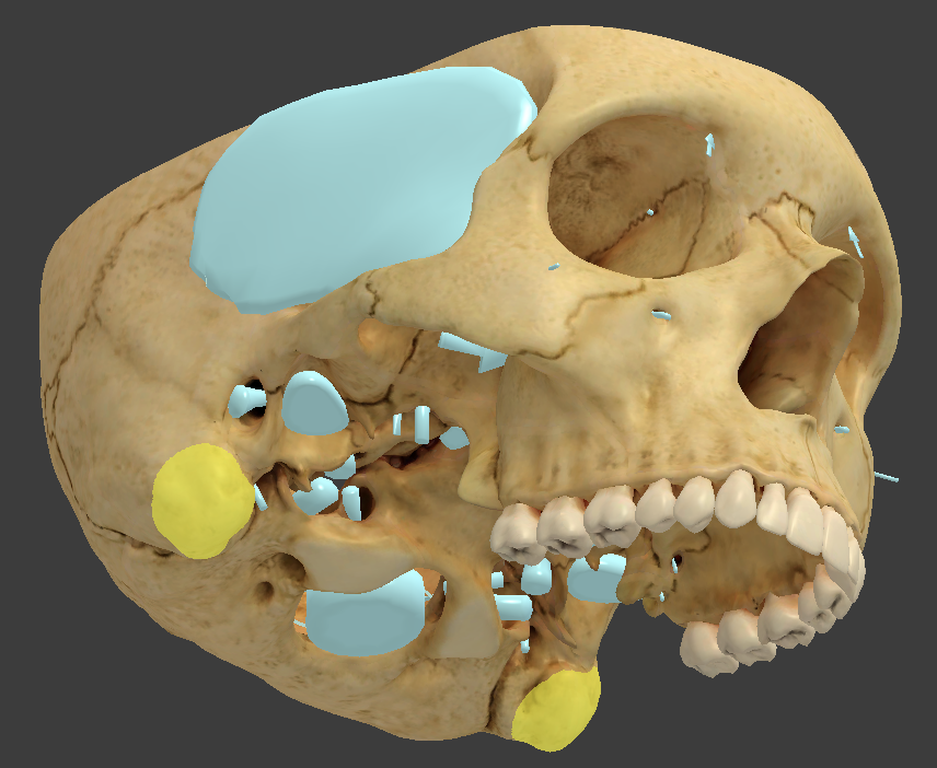 <ul><li><p>lump behind the ear </p></li><li><p>filled with small air sinuses</p></li></ul><p></p>