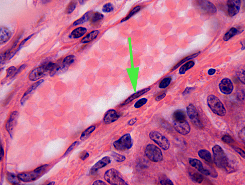 <p><span>What is the name of the layer indicated by the green arrow? <strong>endothelium</strong></span></p>
