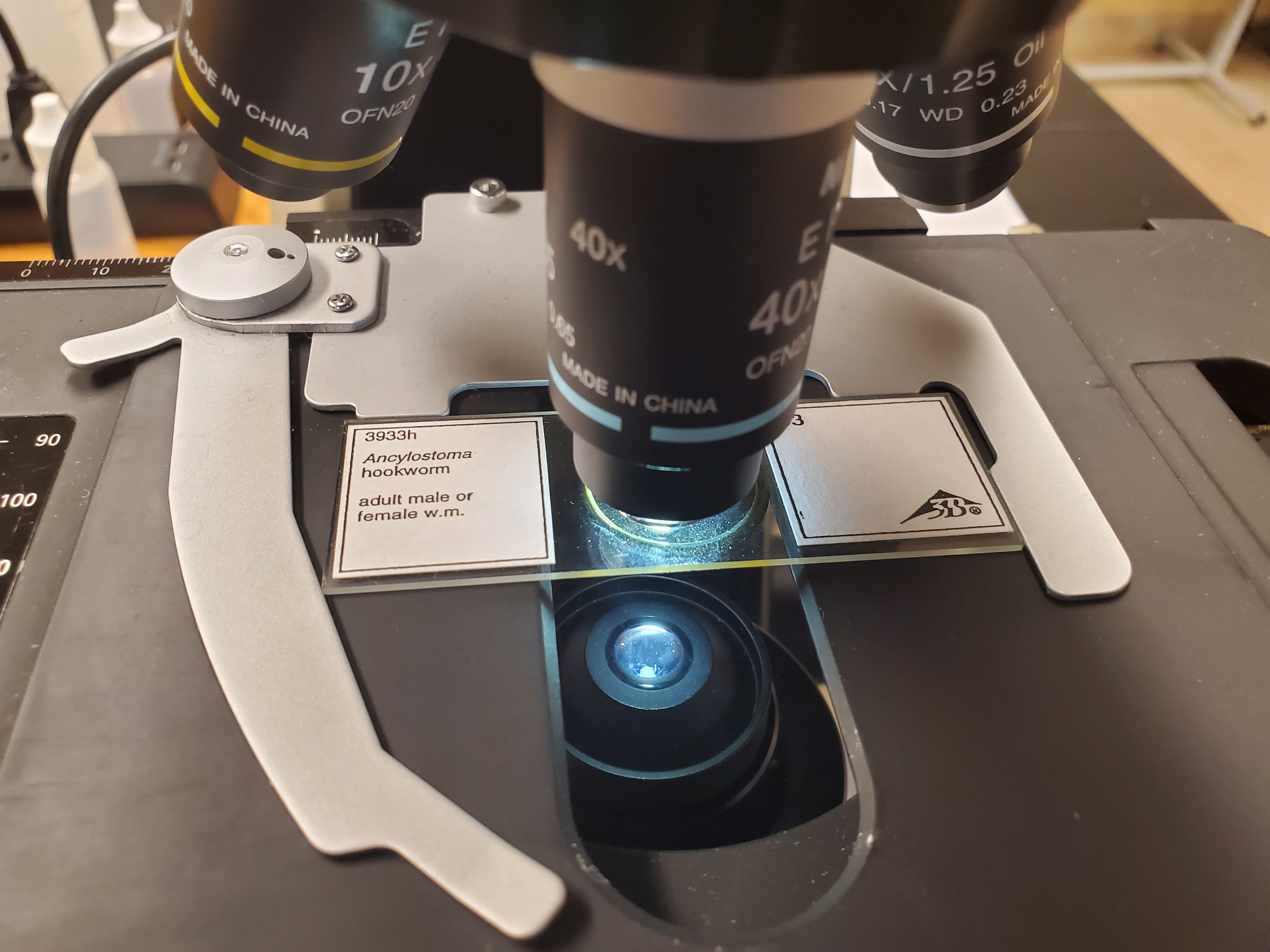 <p>Ancylostoma Male Anterior End</p>