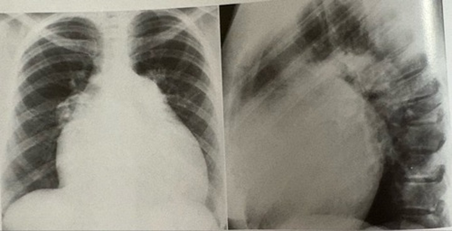 <p>what pathology is present?</p>