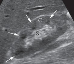 <p>Label the ‘C’ and ‘S’ on the image.</p>