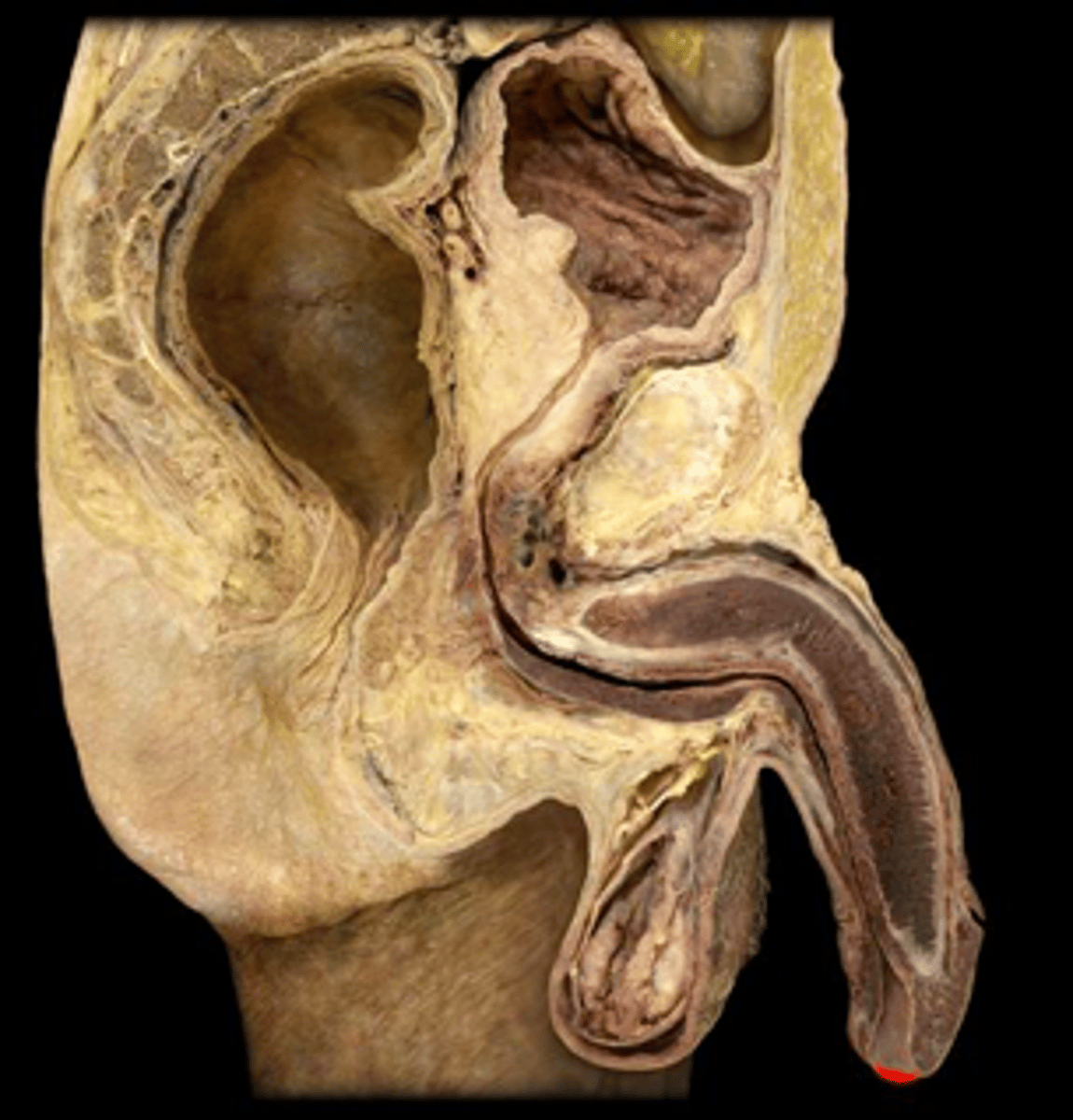 <p>Identify this reproductive structure.</p>