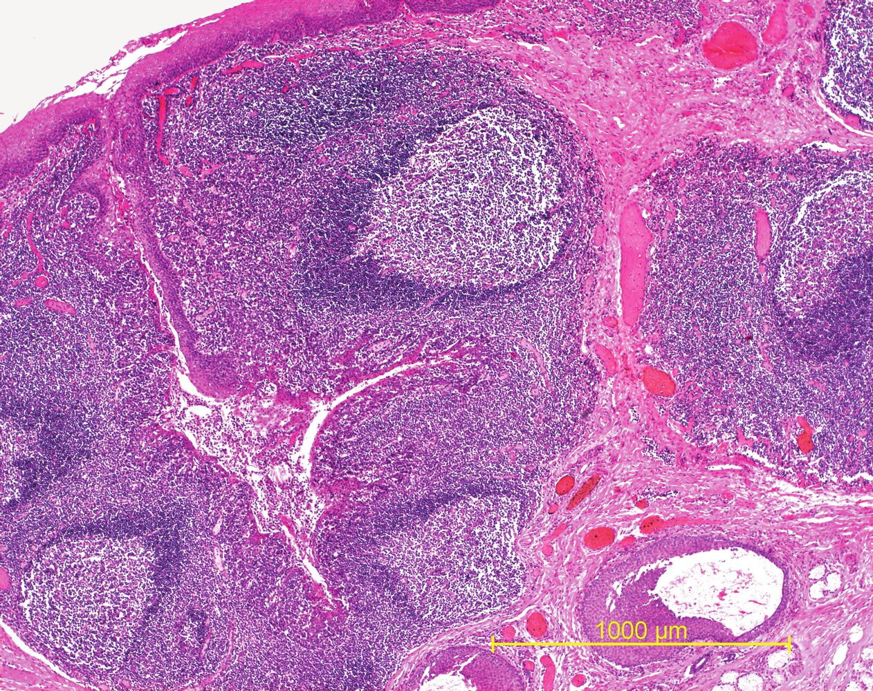 <p>15. Which organ or tissue is shown in the image?</p><p>A. Thymus</p><p>B. Spleen (Milz)</p><p>C. A tonsil</p><p>D. A lymph node</p><p>E. Peyer’s patches</p>
