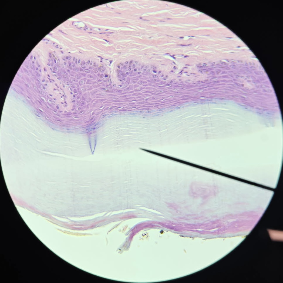 <p>Keratinized Stratified Squamous Epithelium</p>