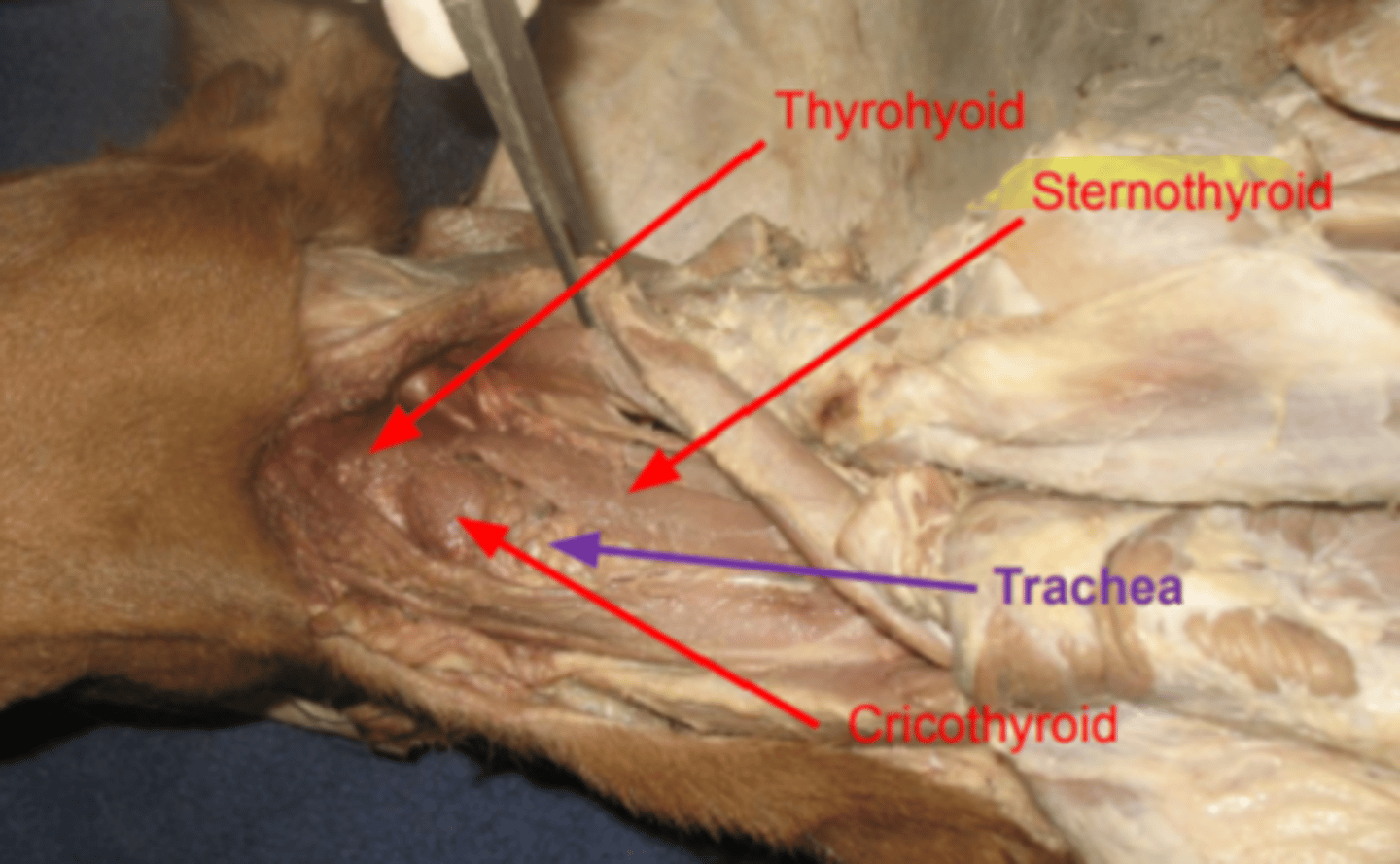 <p><span class="bgP">Innervate :</span>   hyoid bone</p><p><span class="bgP">origin : </span> thyroid cartilage </p>