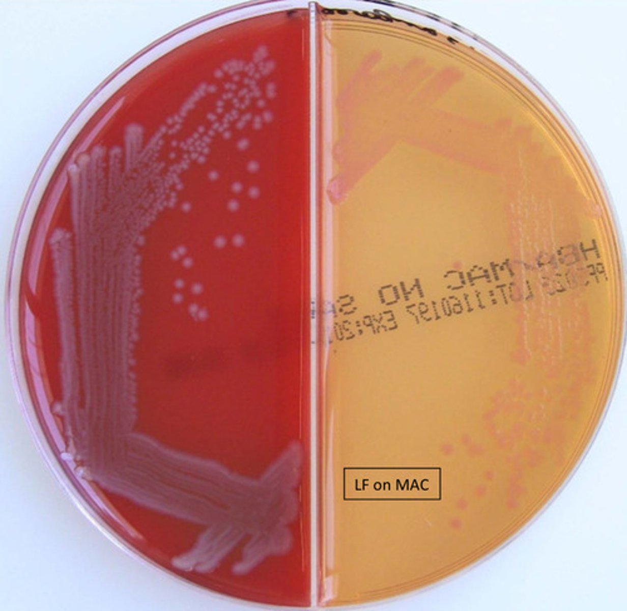<p>GNB, oxidase neg, motile, lactose fermenter (medium pink), PYR pos</p>
