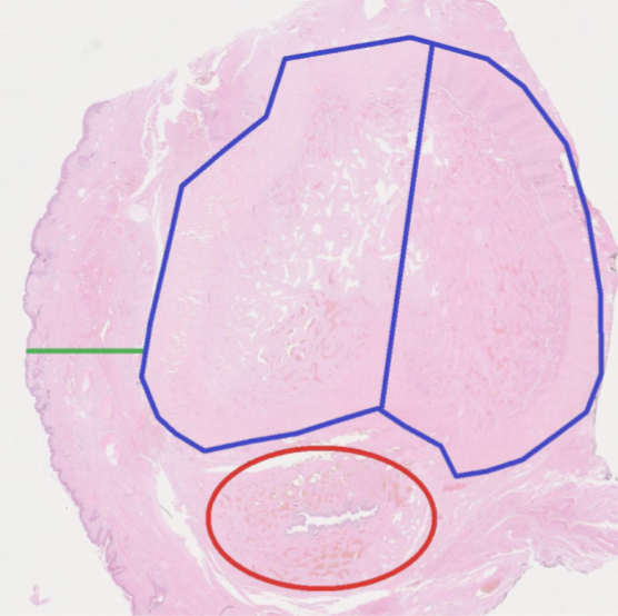 <p>Penis är täckt med keratiniserat skivepitel (förutom glans och insidan av förhud). Mellan epidermis och svällkroppar finns två fascia som är svåra att se. </p><ul><li><p>Blått: Tunica albuginea och corpora cavernosa</p></li><li><p>Rött: Urethra och corpus spongiosum</p></li><li><p>Grönt: Epidermis och dartos fascia + penil fascia. </p></li></ul>