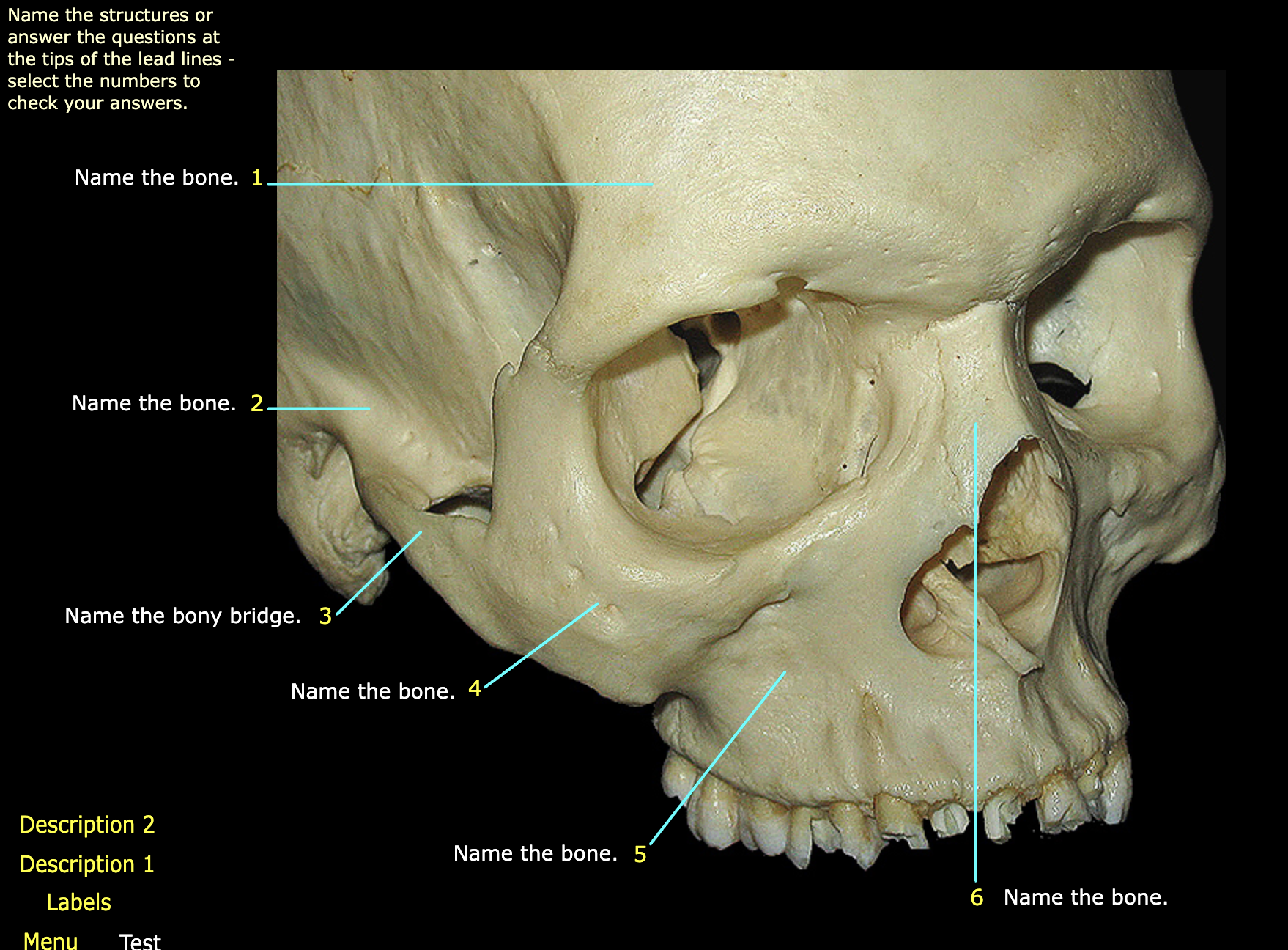 What structure is labeled 4?