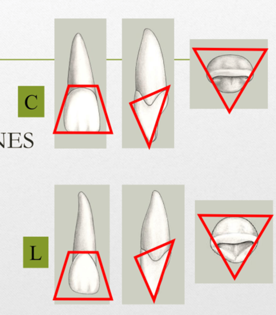 <p>Trapezoidal</p><p>Triangular</p><p>Triangular</p>