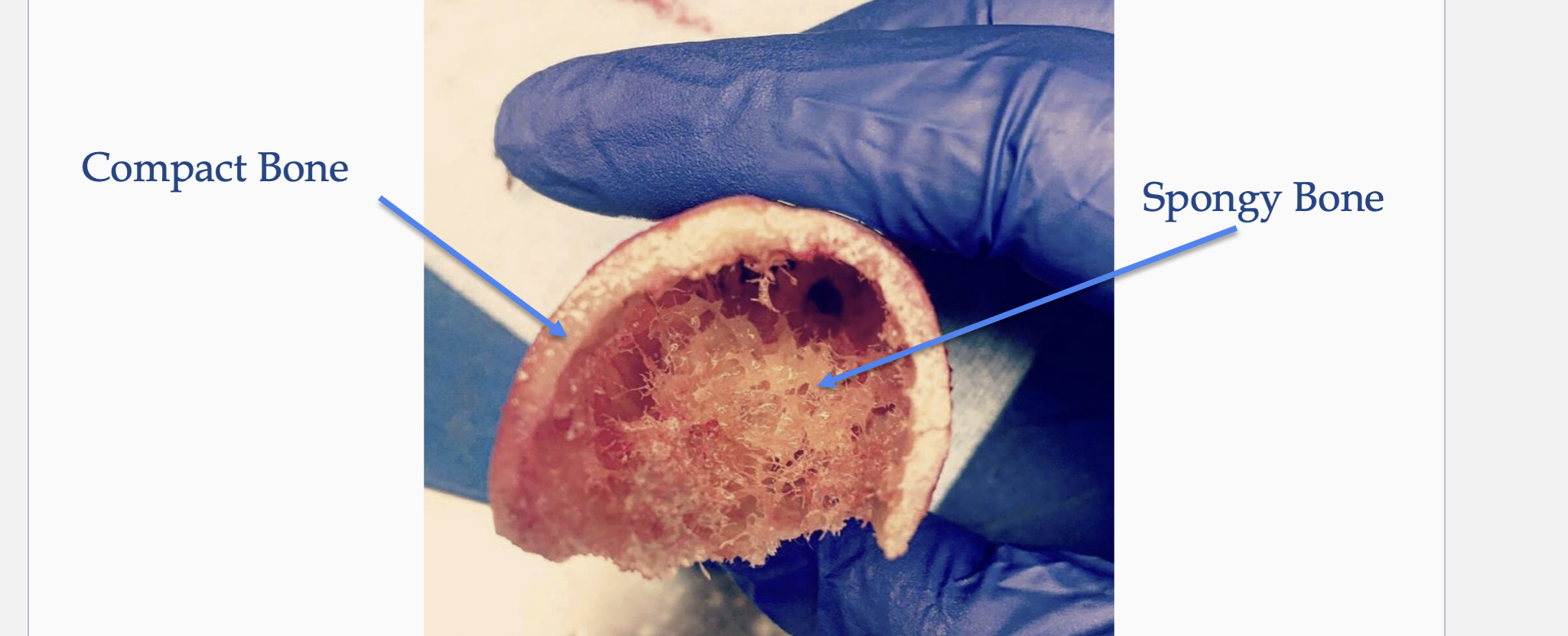 <p>Named: Cortical or Dense </p><ul><li><p><strong>Solid</strong> &amp; Dense </p></li><li><p><strong><mark data-color="#f6cdf6" style="background-color: rgb(246, 205, 246); color: inherit;">Forms at the external walls </mark></strong></p></li></ul><p></p>