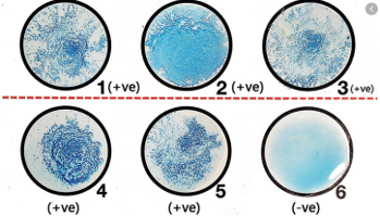 <p><mark data-color="yellow">Chemical reactions – latex antibodies</mark></p><p>Can you label, describe and explain what this diagram is/shows?</p>