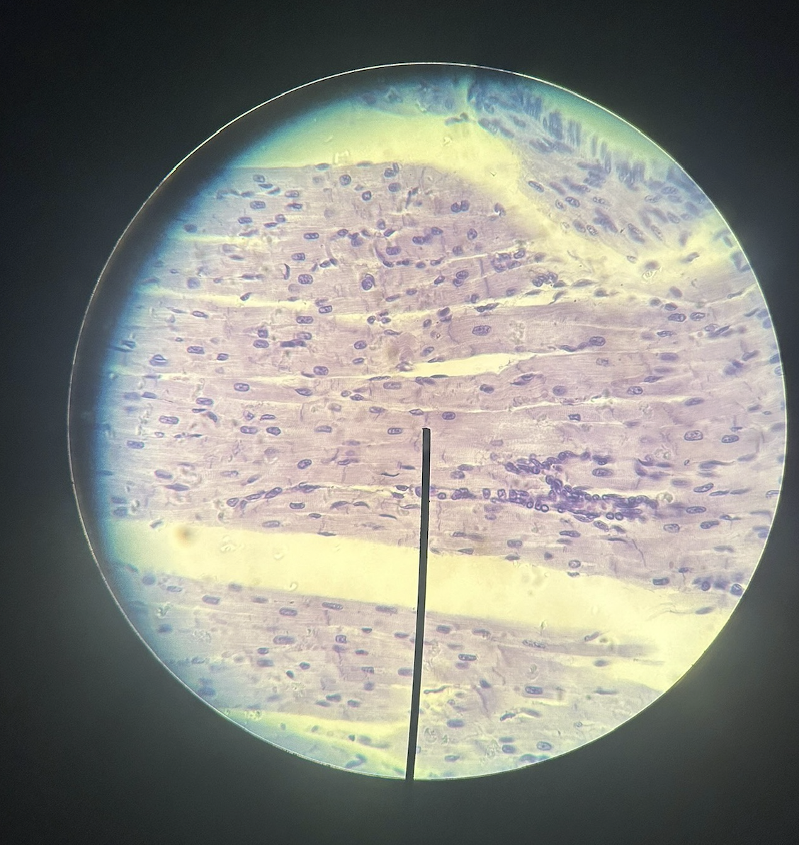 <p>name the muscle type</p>