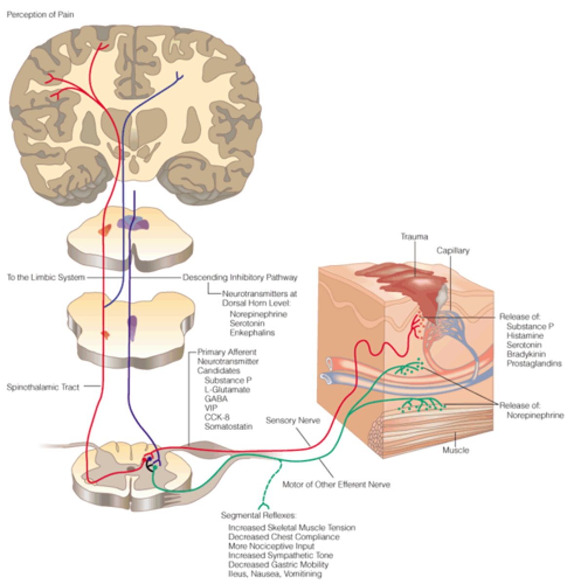 <p>Nociceptors that only respond to intense stimulation either by chemical, mechanical, or thermo stimulation.</p><p>there are 3 types located throughout the body</p><p>1. Cutaneous (skin)</p><p>2. somatic (joints & bones)</p><p>3. visceral (body organs)</p>