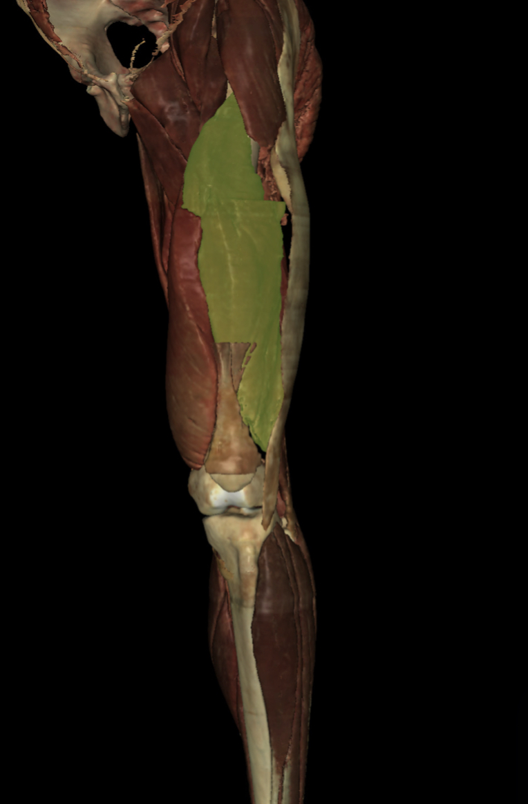 <p>Identify the Structure</p>