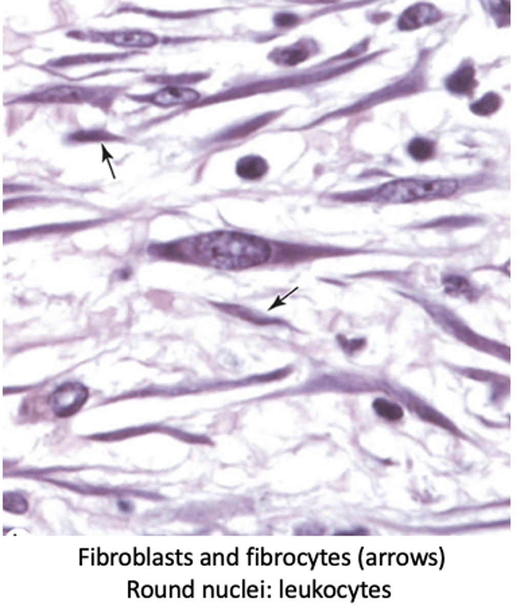 <p>Describe the nucleus of fibrocytes.</p>
