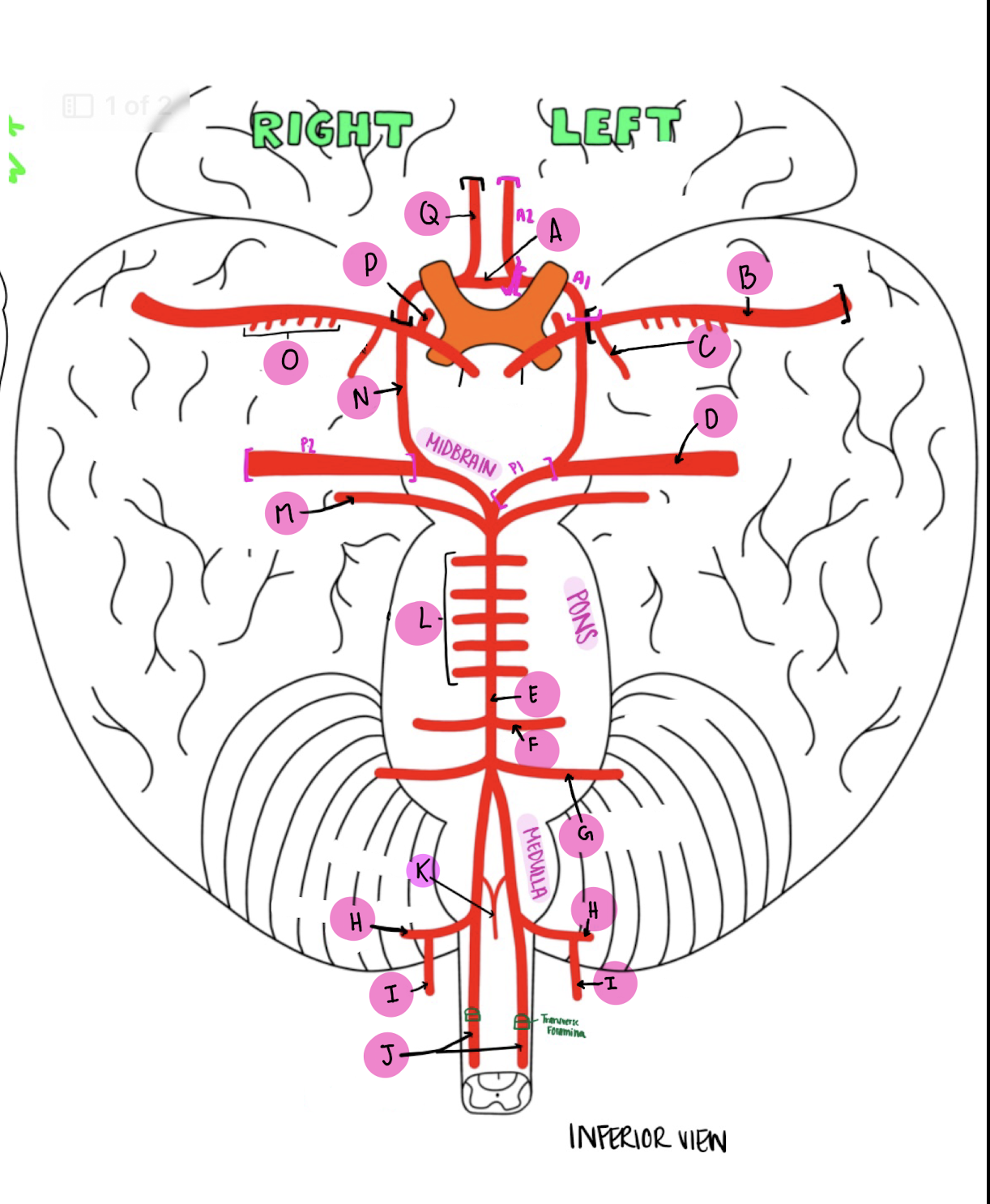 <p>What artery is labeled N?</p>