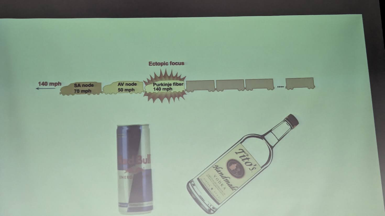 <p>when HR goes to a very high rate, originating from  anywhere other than the “start” point. (SA node)</p><p>-HR becomes out of wack</p><p>-can happen mixing caffeine with alcohol</p>