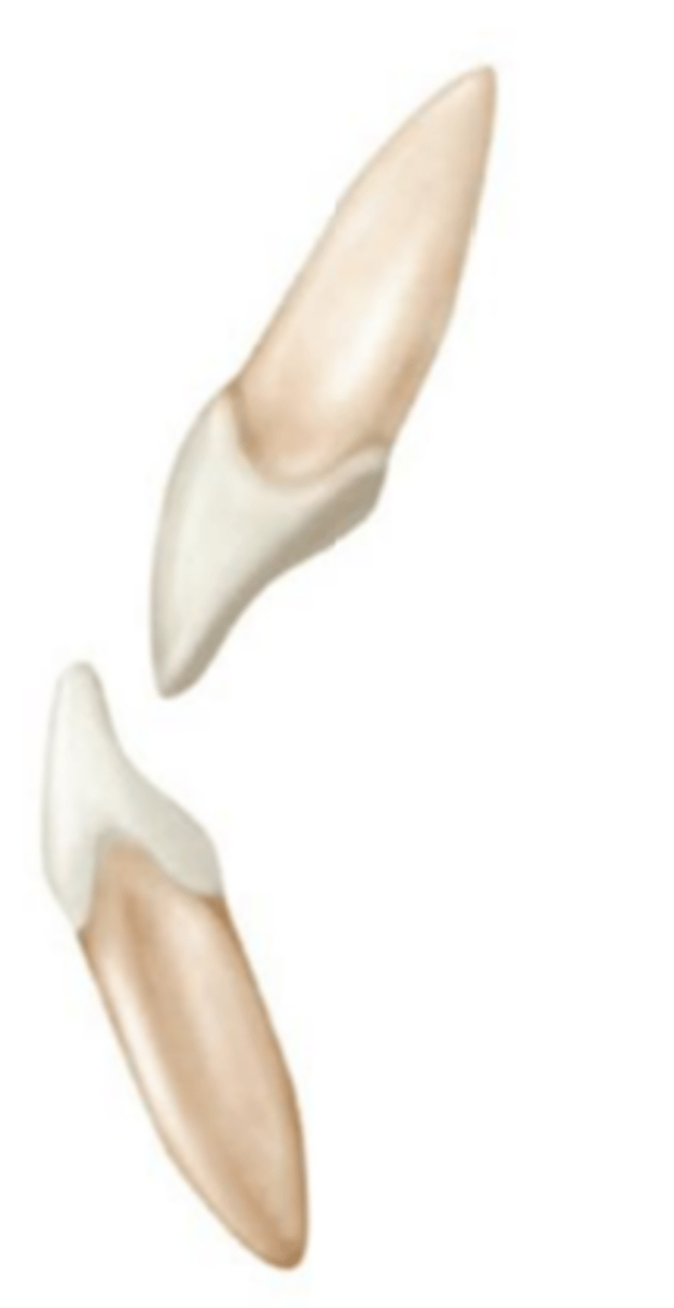 <p>C) mandibular incisal edges occlude with maxillary incisal edges</p>