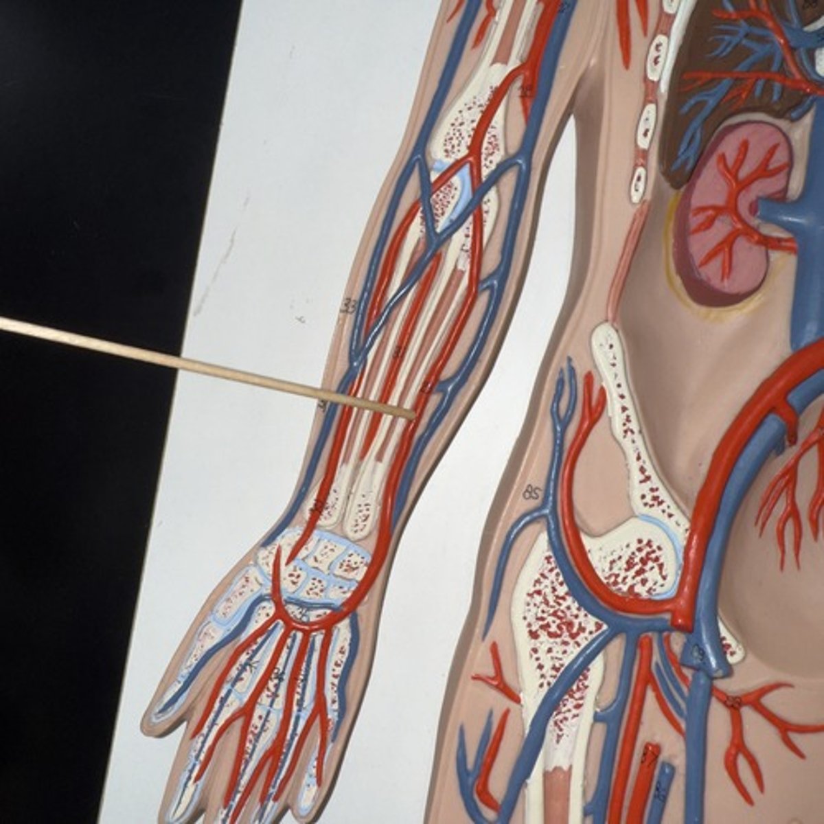 <p>Identify the structure.</p>