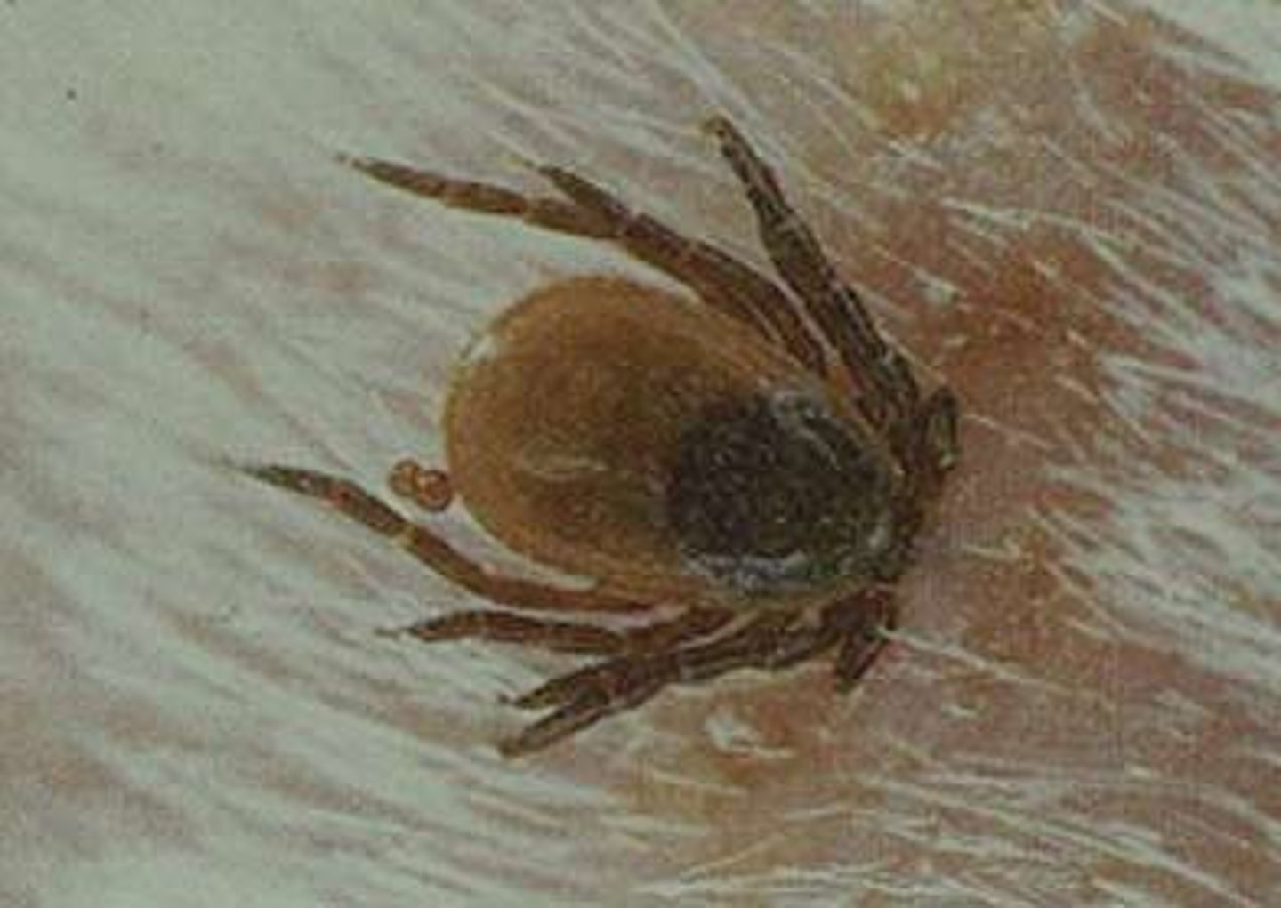 <p>When one organism benefits while the other is harmed. Ex. Tick and Dog. :) :(</p>