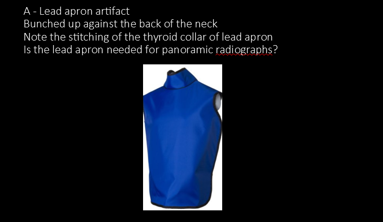 <p>A. Lead apron/thyroid collar too high and bunched up in the back</p>