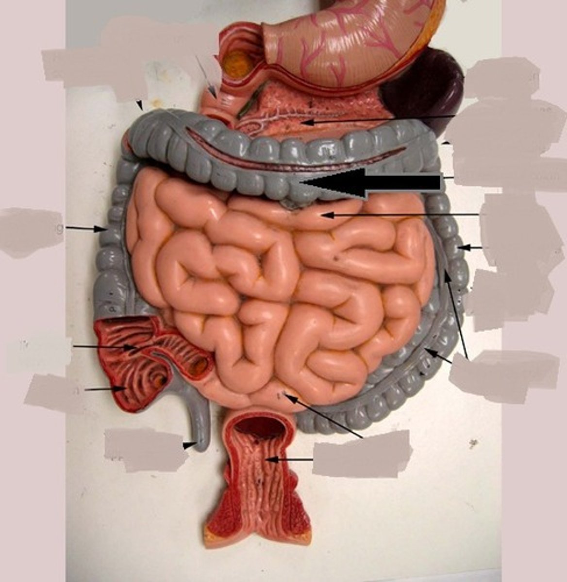 <p>courses from ascending to descending colon</p>