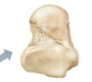 <p>What classification of bone is this?</p>