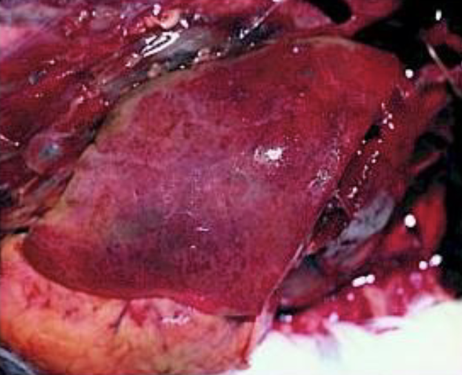 <p>what mycotoxin caused this liver pathology</p>