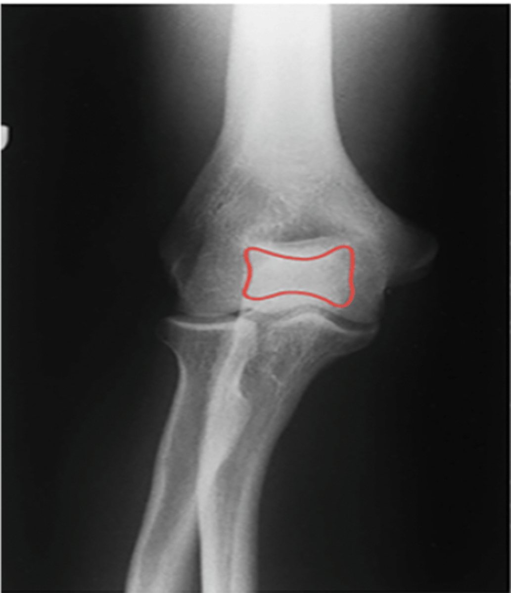 <p>What structure is highlighted?</p>