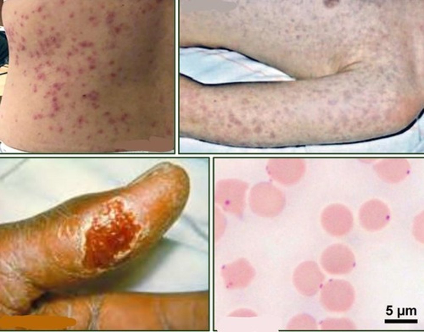 <p>Francisella spp.</p>