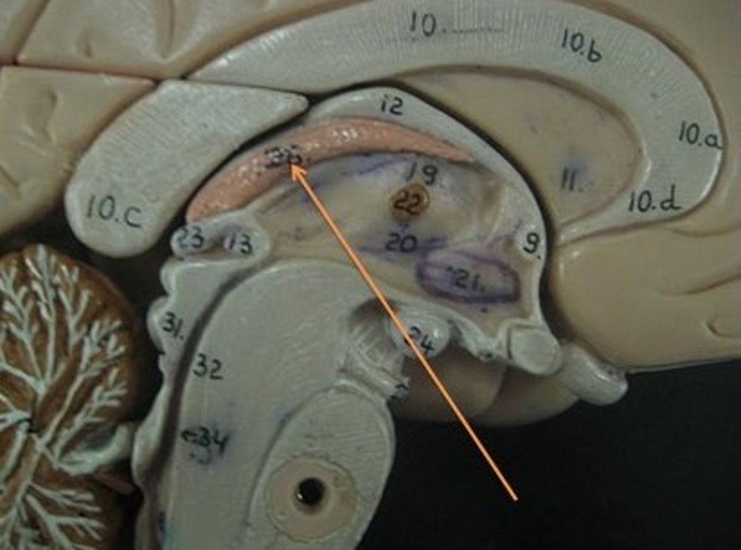 <p>A highly vascular portion of the lining of the ventricles that secretes cerebrospinal fluid.</p>
