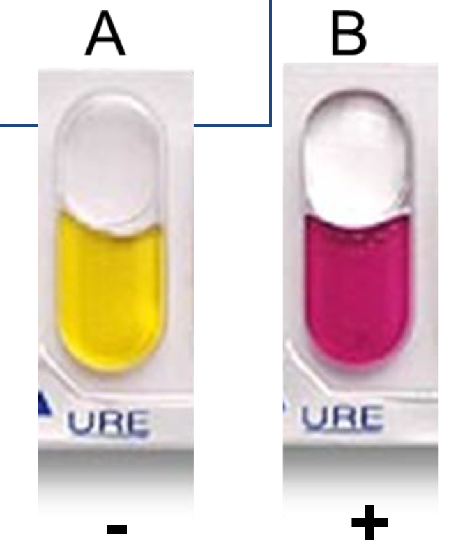 <p>Urease (URE)</p><p>Determine if bacteria can hydrolyze urea by urease.</p>