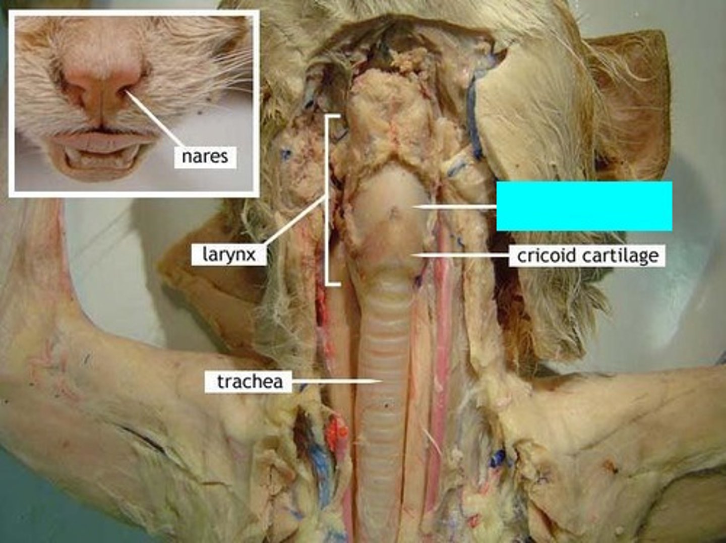 <p>thyroid cartilage is superior to cricoid cartilage</p>