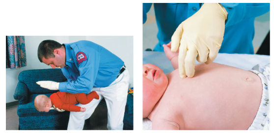 <p><span><span>Support the head and alternate between 5 back slaps (prone) and 5 chest thrusts (supine) with head lower than body.</span></span></p>