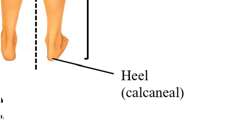 <p>calcaneal</p>