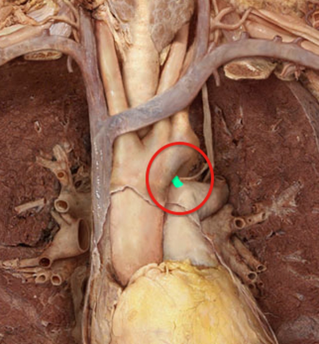 <p>between aortic arch and pulmonary trunk</p>