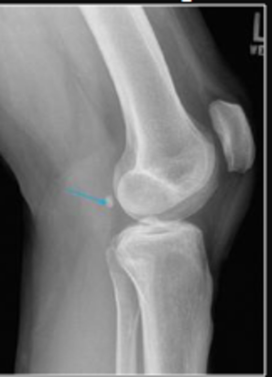 <p>What are the arrows pointing to?</p>