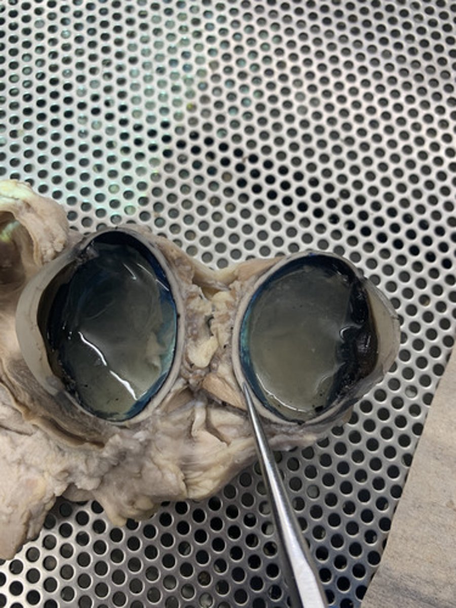 <p>white part of the fibrous tunic</p>