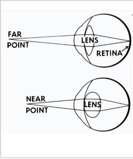 <ul><li><p>muscle shaped like a donut that can alter the shape of the lens</p><ul><li><p>lens has natural tendency to become round, but is attached to ciliary body by suspensory ligaments</p></li><li><p>ligaments pull on lens and make it have a lesser curvature</p></li></ul></li><li><p>When look at distance object, lens is pulled into a relatively flat shape</p><ul><li><p>as you move an object closer, tension of the ligaments is lessened and the lens becomes more round</p></li><li><p>new shape bends light to a greater degree and the image stays focused on the retina of the eye</p></li><li><p>accommodation- increasing curvature to maintain focus</p></li></ul></li><li><p>as we age, eye loses some of its elasticity and its ability to get as round</p><ul><li><p>presbyopia- cant focus on near objects</p><ul><li><p>why a person holds phone book or newspaper farther</p></li></ul></li></ul></li></ul><p></p>
