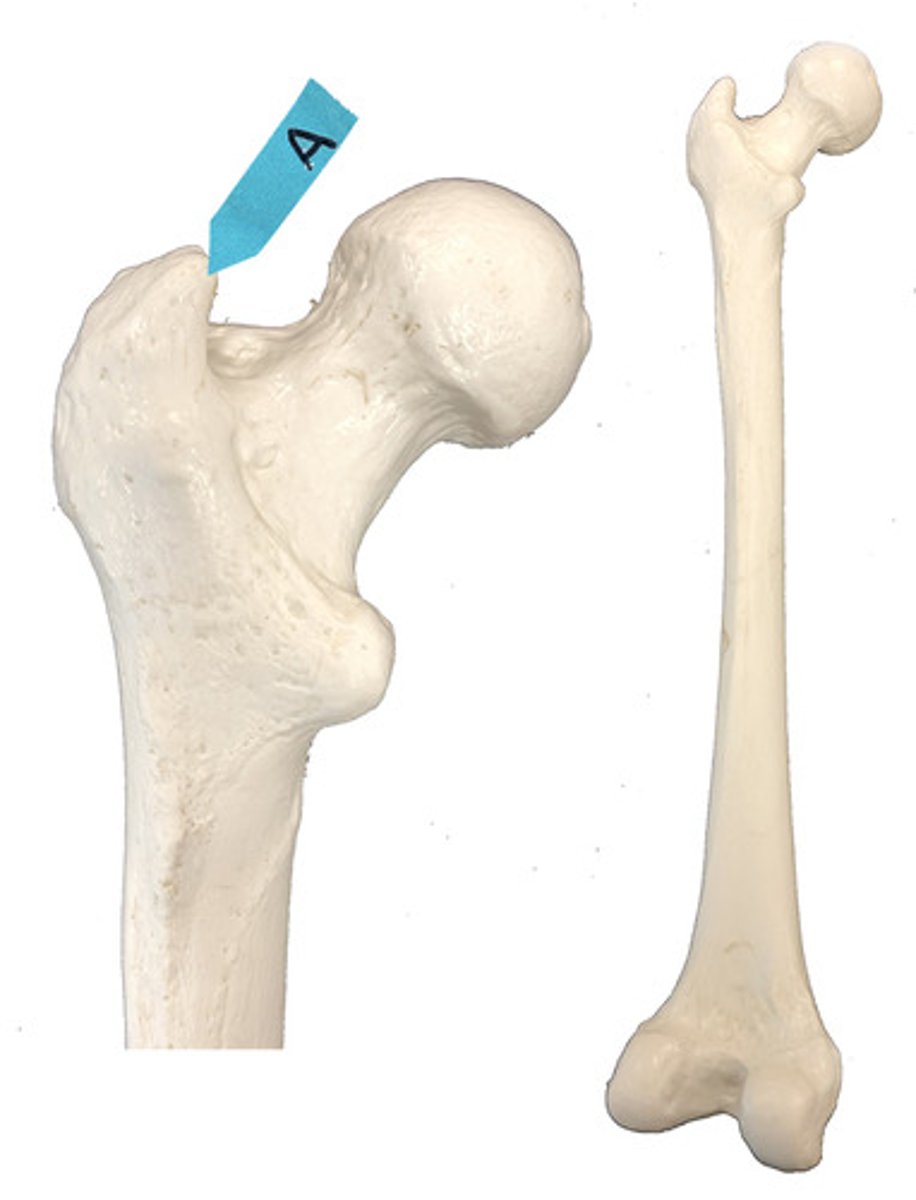 <p>Identify this bone marking.</p>