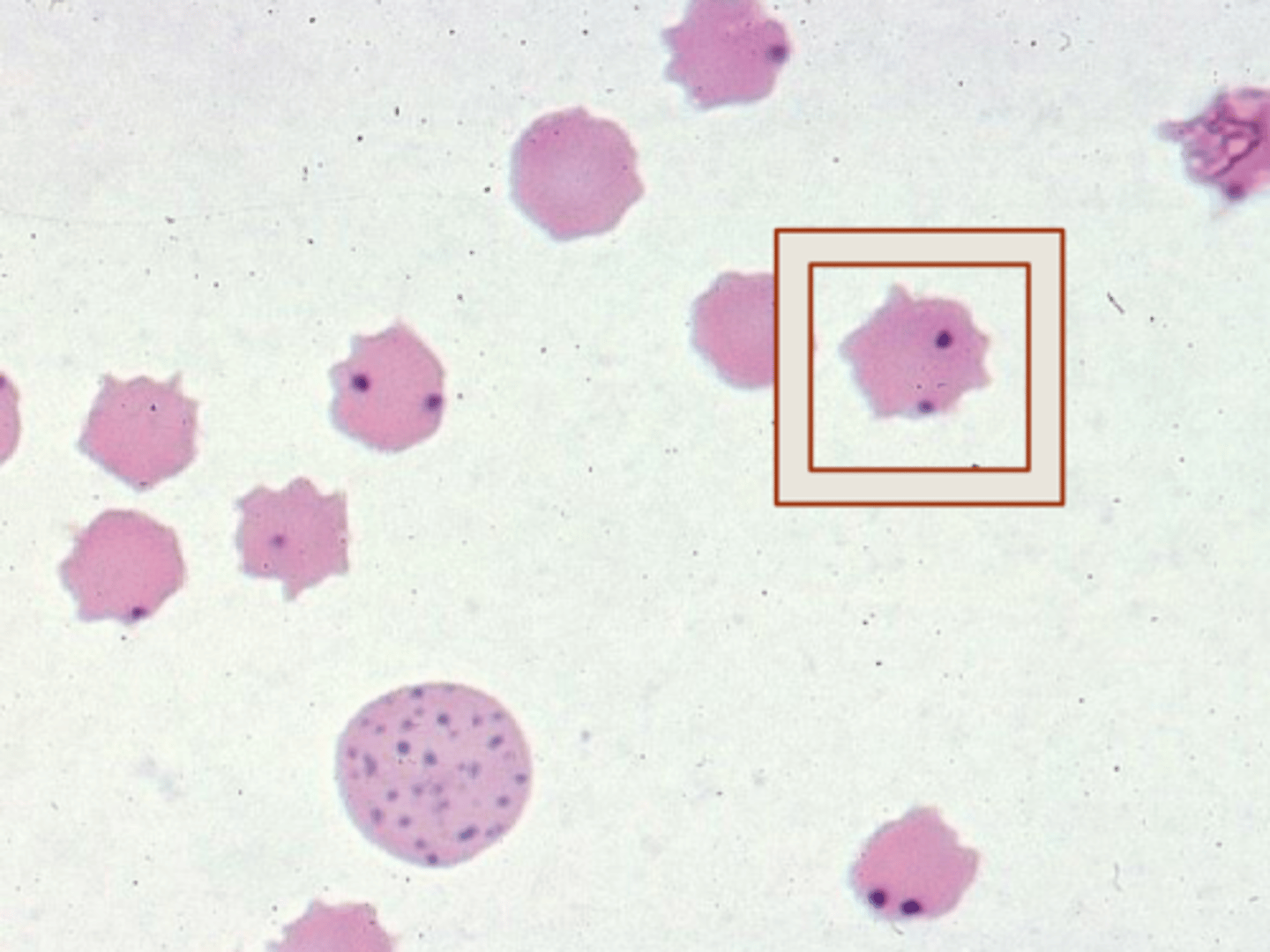 <p>What is the following parasite?</p>