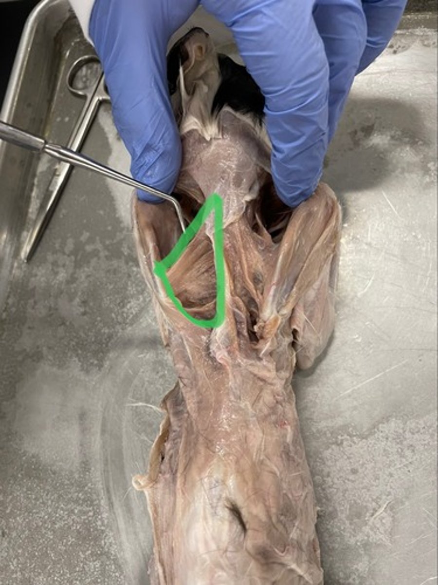 <p>O: thoracic vertebrae</p><p>I: medial border of scapula</p><p>A: stabilize scapula; retract scapula</p>