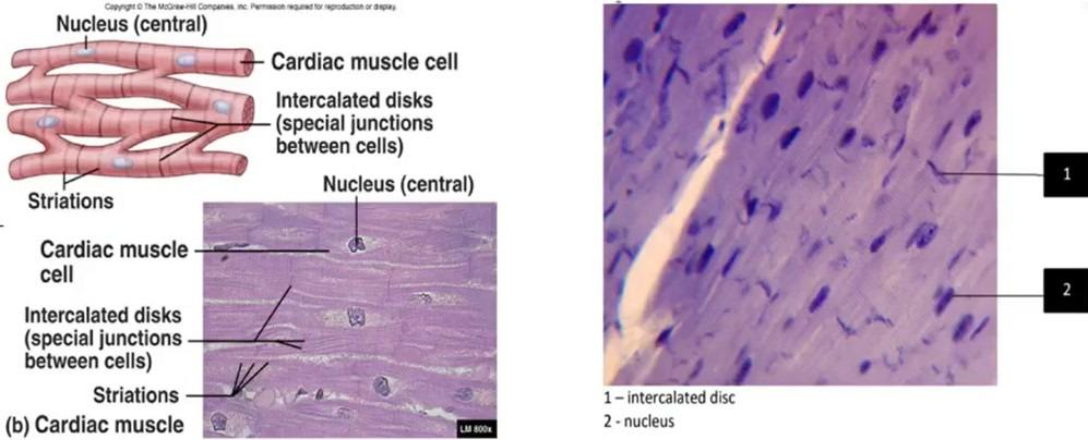 <p>Cardiac </p><p>-has intercalculated discs </p><p>-single nucleus per cell</p><p></p>