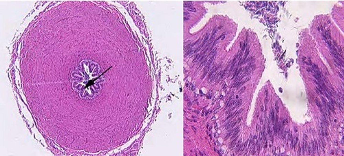 <p>Identify the organ, its function, the epithelium, and any tunica.</p>
