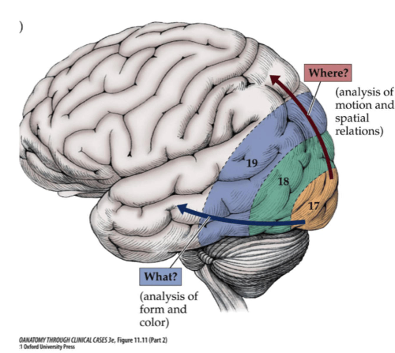 <p>Inferior occipito-temporal cortex</p>