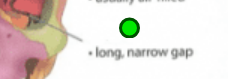 <p>Opening, <span>slit. Houses nerves and blood vessels. Ex. Skull, superior and inferior orbital. </span></p>