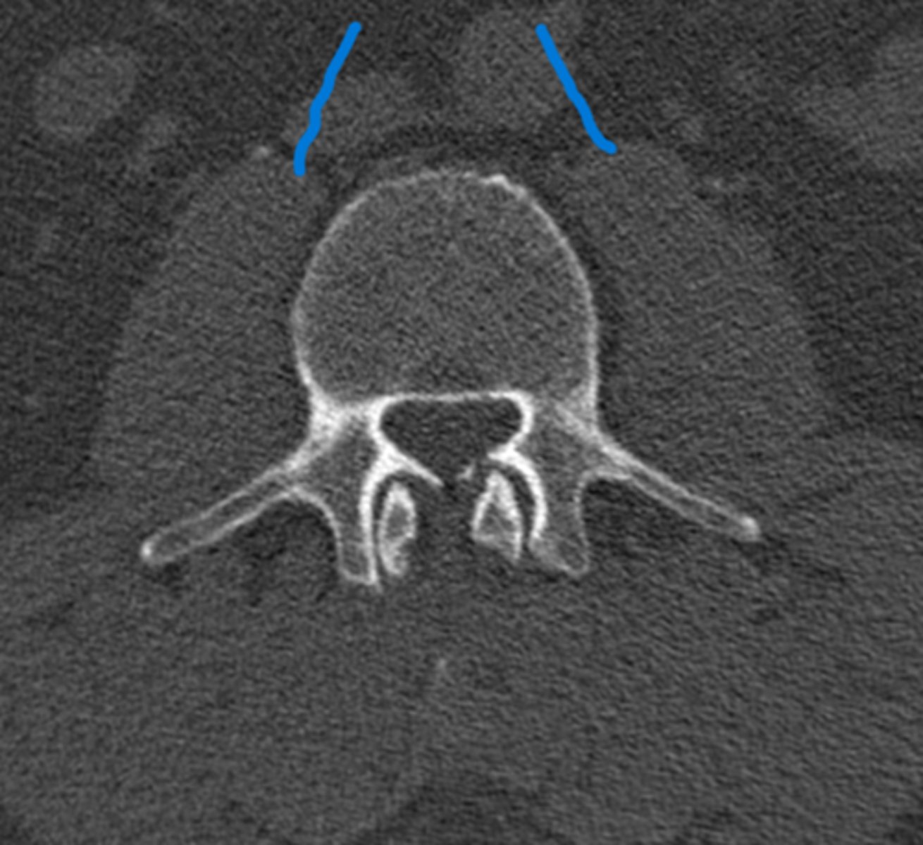 <p>What are the blue lines pointing to</p>