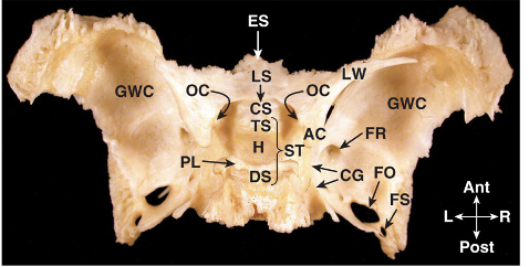 <p>What area of the sphenoid does ES stand for?</p>