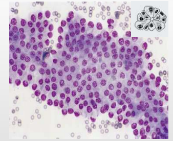 <p>Types of Tissue Cells - Epithelial Cells</p><p>Features?</p><p>Cellularity of slides?</p><p>Distribution on slide?</p>